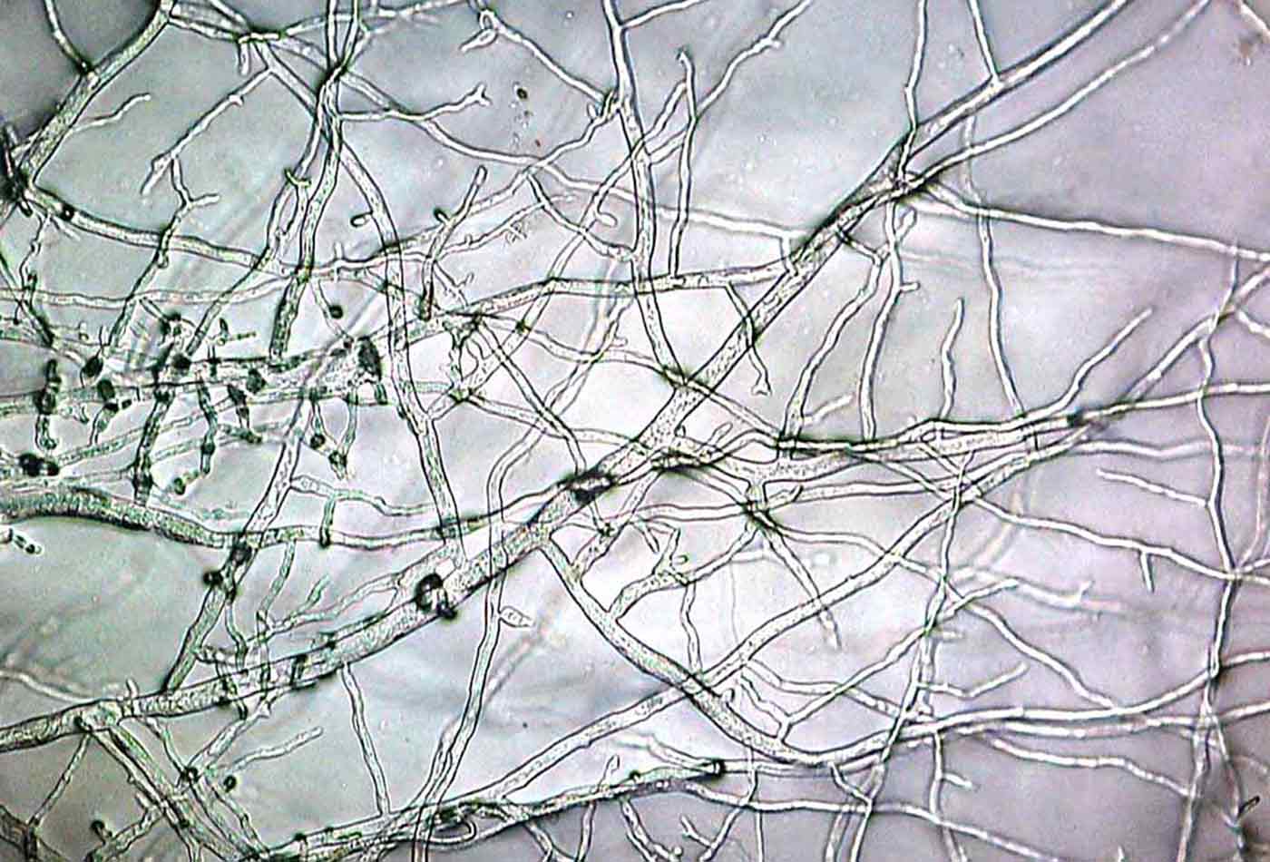 Mycelium under a microscope.